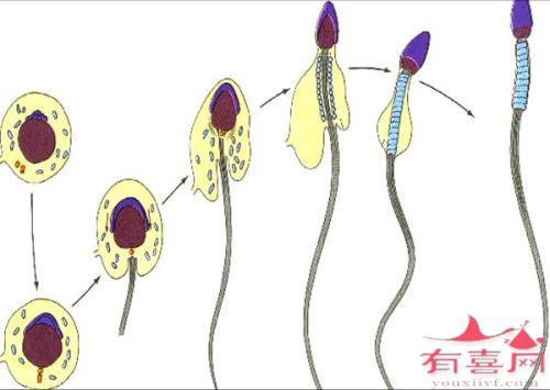 无精症能做试管婴儿吗