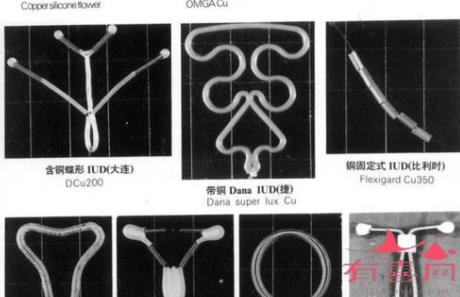 节育环的种类图片