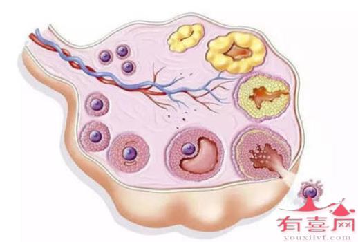 使卵泡破裂的最好方法是什么