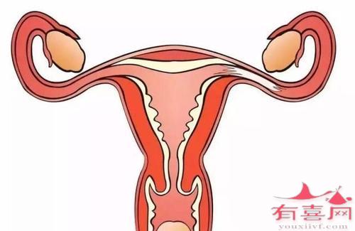 抗子宫内膜抗体弱阳性什么方法可以治疗