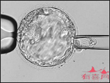 囊胚PGS通过率有多高呢