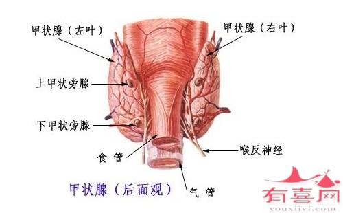 桥本甲状腺炎是什么意思