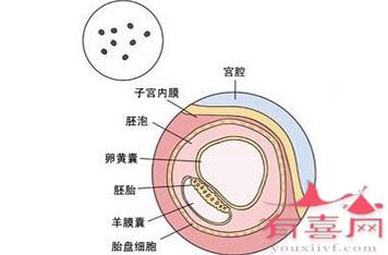 怀孕空囊是什么意思