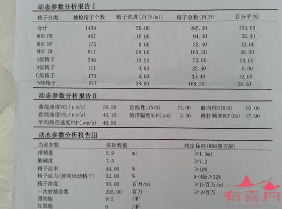 做一个精子检查大概多少钱