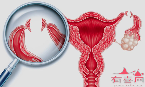 输卵管发育不良如何怀上自己的宝宝