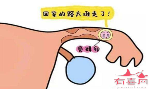 输卵管发育不良怀孕几率高吗