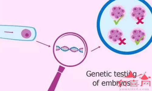三代试管婴儿基因筛查最大程度控制遗传