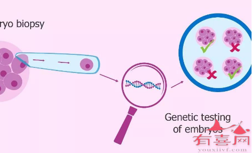 三代试管婴儿能从源头阻止将疾病传染给后代
