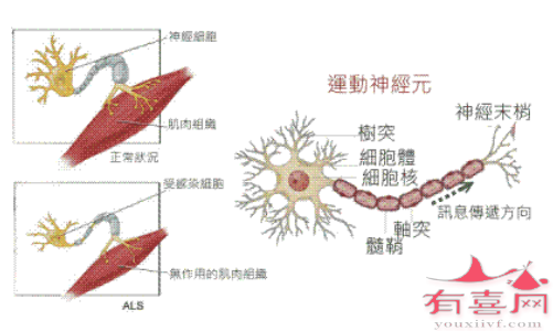 SMN蛋白缺失导致运动神经元不能保持健康状态