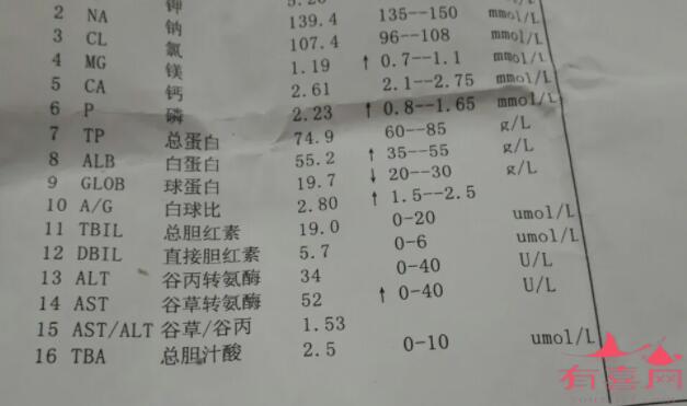 谷草转氨酶正常值是多少