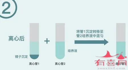 Perecoll梯度离心精子洗涤技术