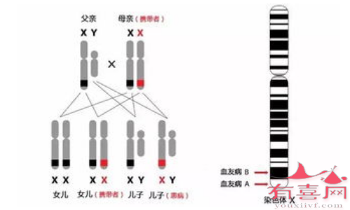 血友病遗传模式