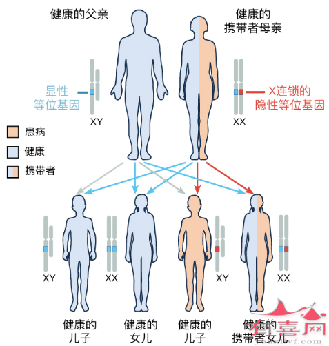 假肥大性肌营养不良遗传模式