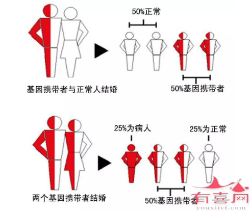 地中海贫血遗传模式