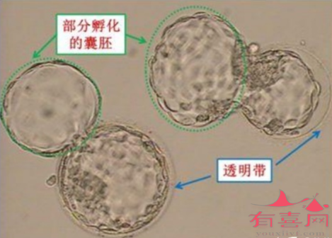 部分孵化的囊胚示意图