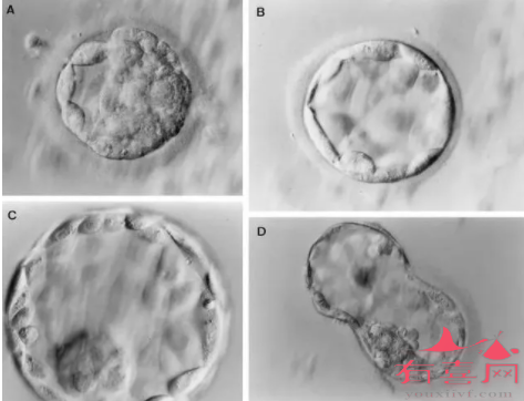 囊胚等级示意图