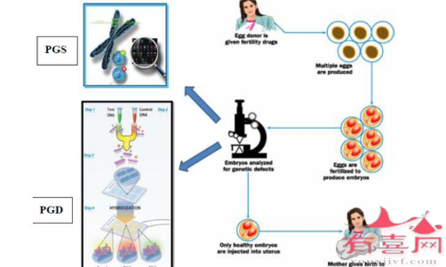 三代试管技术实现优生优育