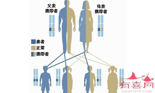 I型糖原累积病遗传规律