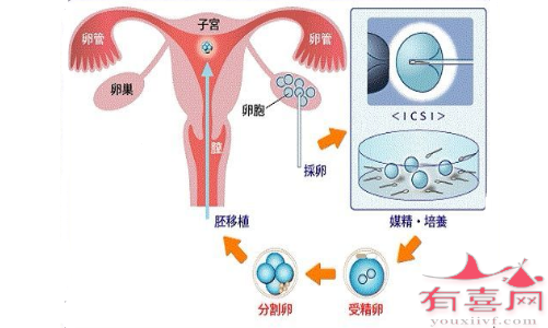 糖原累积病可以做试管吗