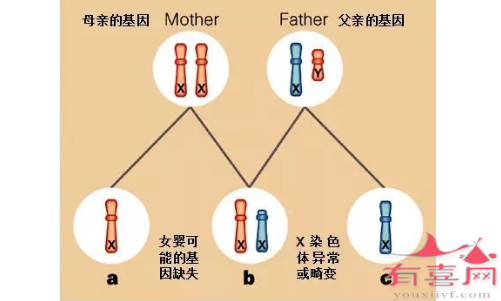 特纳氏综合征病因与X染色体相关