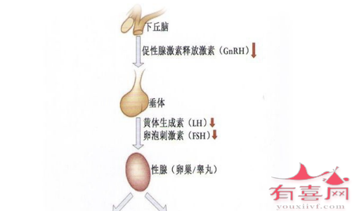 患者常见性腺功能减退症