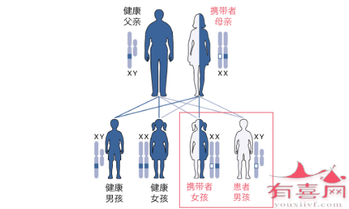 脆性X综合征遗传几率