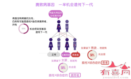 脆性X综合征能遗传几率