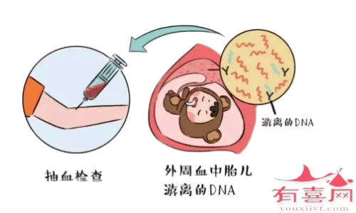 对外周血细胞染色体核型分析