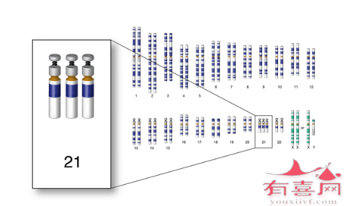 21三体型不遗传