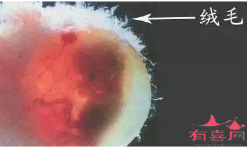 绒毛膜绒毛取样