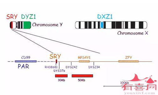 发病原因与关键的SRY基因有关