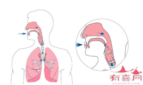 遗传性血管性水肿治疗