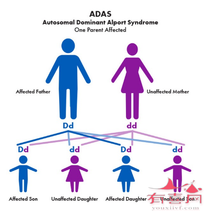 Alport综合征常染色体显性遗传