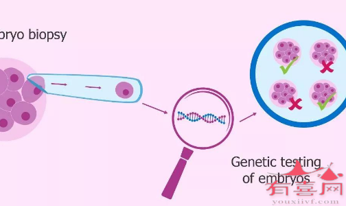 三代试管有效提前避免胎儿染色体异常