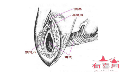 外阴、阴道因素导致不孕