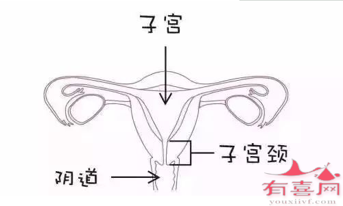 宫颈因素导致的不孕