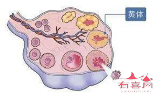 黄体发育不全使孕酮分泌量不足