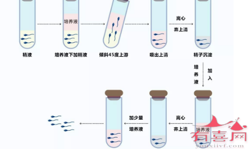 精子洗涤后进行三代试管