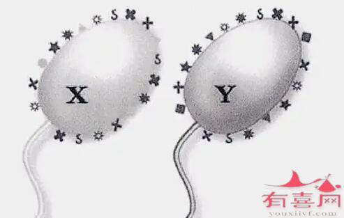 精子分离术是怎么操作的，多少费用