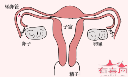 人工授精适合人群