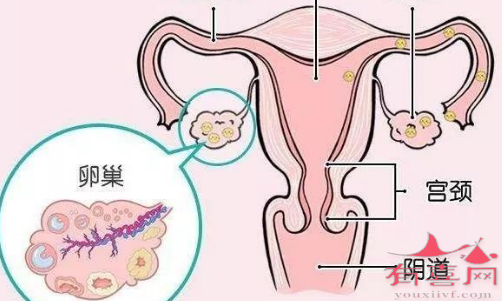 看卵巢、子宫情况