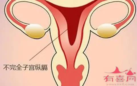 不完全纵膈子宫会给女性带来得危害