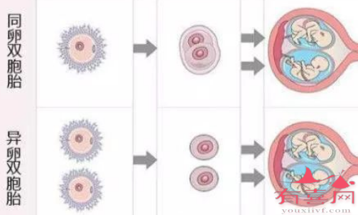 同卵双胞胎是在受精后3天内分裂形成