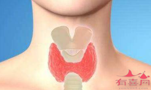 甲状腺囊性结节内多为液体或中空