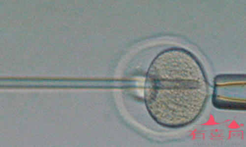 卵母细胞胞浆内单精子注射技术