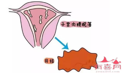 正常情况的月经血块排出