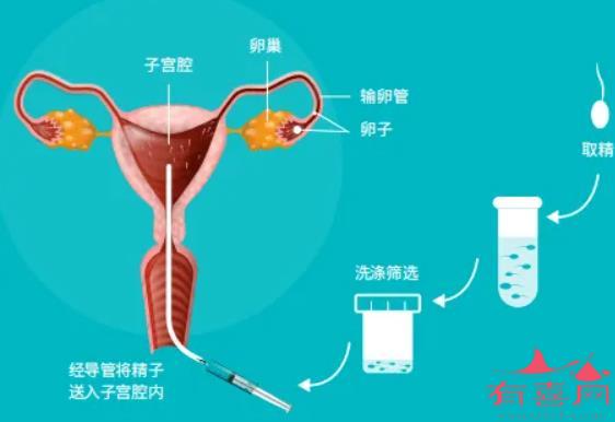 人工授精技术示意图