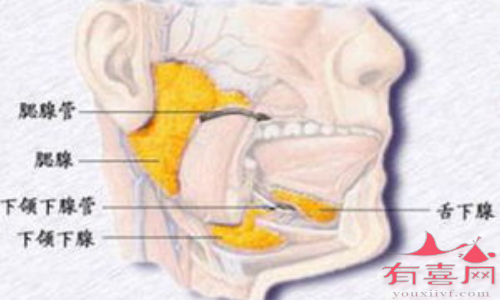 腮腺导管或其一个分支的阻塞