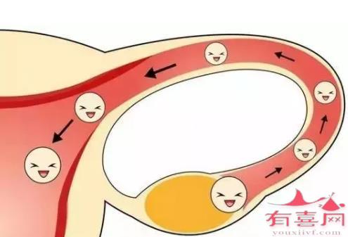 如何确诊输卵管不通