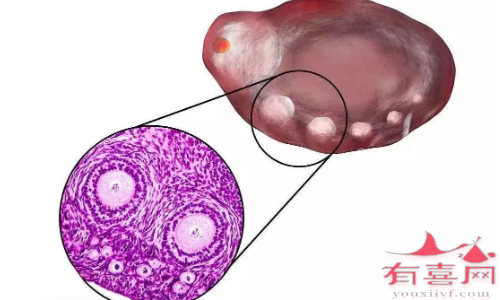 卵泡长着长着就萎缩了怎么回事